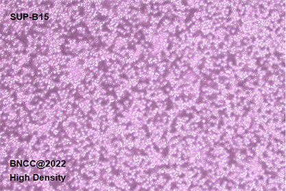 Human bone marrow acute lymphoblastic leukemia cells-BNCC