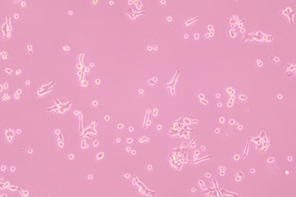 Human pancreatic cancer cells-BNCC