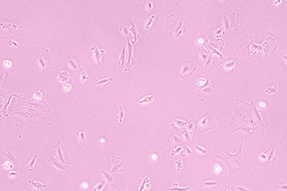 Human chondrosarcoma cells-BNCC
