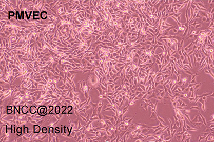 Rat pulmonary microvascular endothelial cells-BNCC