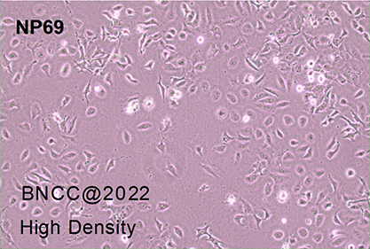 Human nasopharyngeal epithelial cells-BNCC