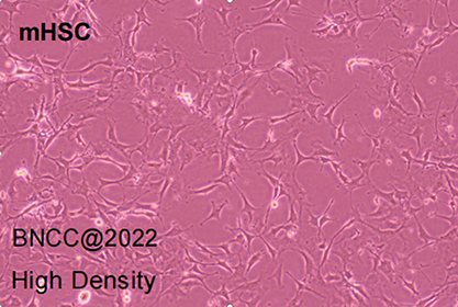 Mouse hepatic stellate cells-BNCC
