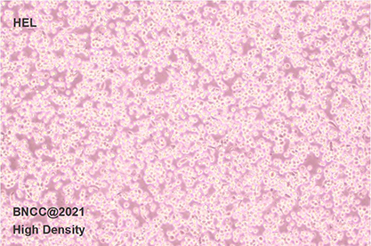 Human erythroleukocyte leukemia cell-BNCC