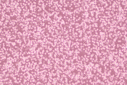 Human Acute B Lymphoblastic Leukemia Cells-BNCC
