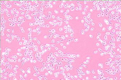 Human thyroid cancer cells (undifferentiated)-BNCC