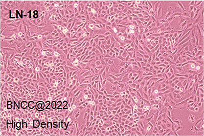 Human glioblastoma-BNCC