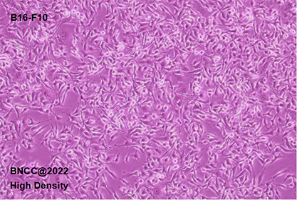 Mouse skin melanoma cells-BNCC