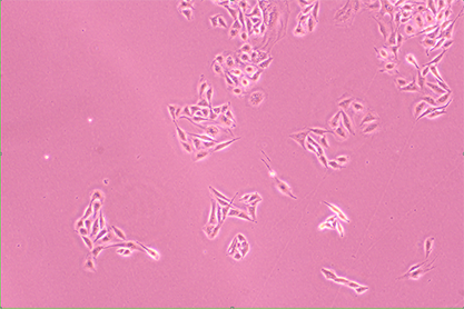 Human adenocarcinoma cells (mouse hybridoma)-BNCC