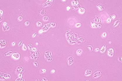 Human thyroid cancer cells (undifferentiated)-BNCC