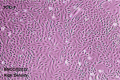 Human thyroid cancer cells-BNCC