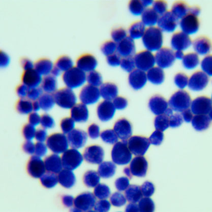 Cryptococcus neoformans-BNCC