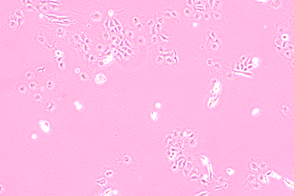 Human thyroid cancer cells-BNCC