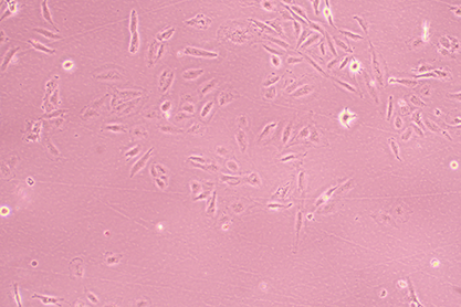 Human bladder cancer cells-BNCC
