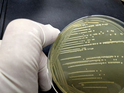 Acinetobacter portensis-BNCC