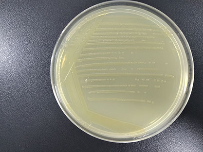 Ureibacillus massiliensis-BNCC