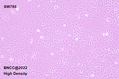 human transitional cell carcinoma of the bladder-BNCC