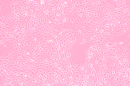 Mouse myeloma cells-BNCC