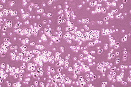 Human liver cancer cells-BNCC