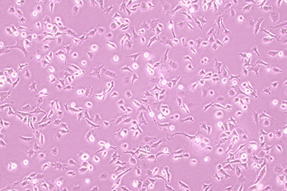 Human epithelial ovarian cancer cells-BNCC