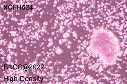 Human non-small cell lung cancer cells-BNCC