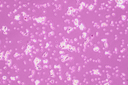 Rat lymphoma cells-BNCC