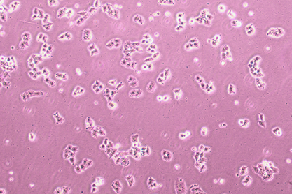 Human liver cancer cells-BNCC