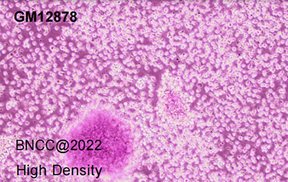 Human B lymphocyte-BNCC
