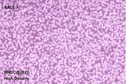 Human B lymphocytic leukemia cells-BNCC