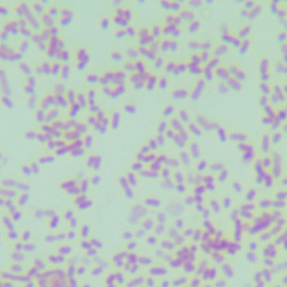 Bacteroides xylanisolvens-BNCC