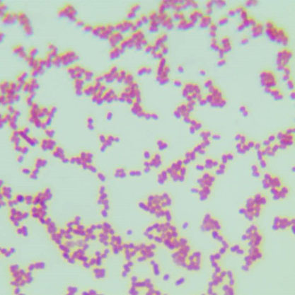 Acinetobacter albenis-BNCC
