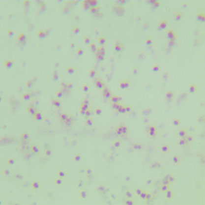 Neisseria gonorrhoeae-BNCC