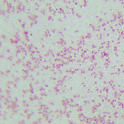Neisseria gonorrhoeae-BNCC