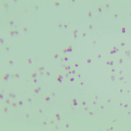 Neisseria gonorrhoeae-BNCC