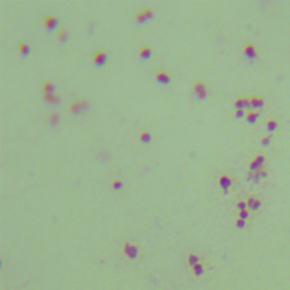 Neisseria gonorrhoeae-BNCC