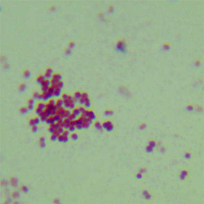 Neisseria gonorrhoeae-BNCC