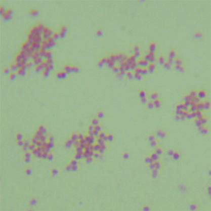 Neisseria gonorrhoeae-BNCC