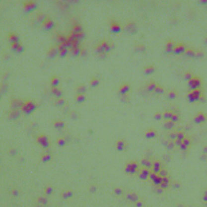 Neisseria gonorrhoeae-BNCC