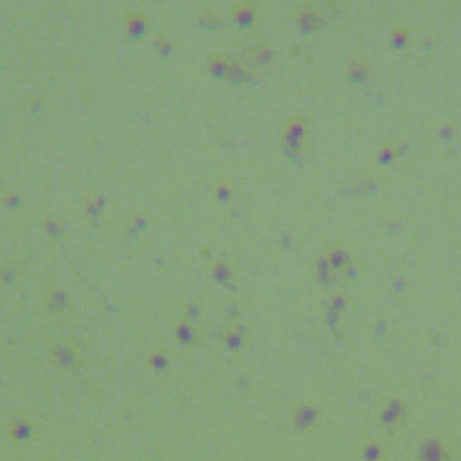 Neisseria gonorrhoeae-BNCC