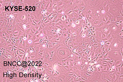Human esophageal squamous cell carcinoma-BNCC