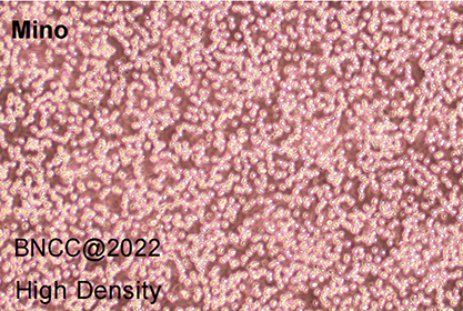 human mantle cell lymphoma-BNCC