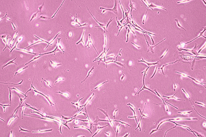 Human thyroid cancer cells (undifferentiated)-BNCC