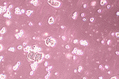 human cecum cancer cells-BNCC