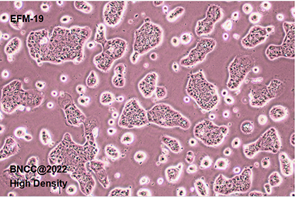 Human mammary duct cancer cells-BNCC